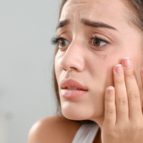 girl stressing that her lashes are falling out